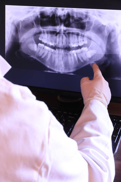 Best Knocked-Out Tooth (Avulsed Tooth) Treatment in Spring Grove, MN