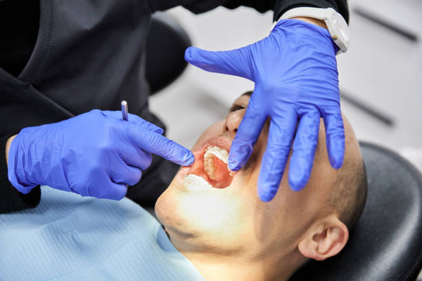 Best Emergency Wisdom Tooth Extraction in Spring Grove, MN